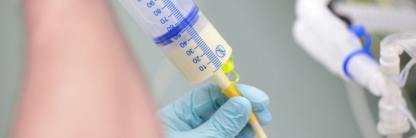 Process,Of,Feeding,The,Patient,Through,The,Tube,In,Critical
